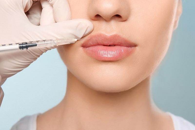 tiêm filler bao lâu thì có bầu được